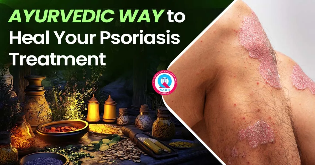ayurvedic-way-to-heal-your-psoriasis-treatment